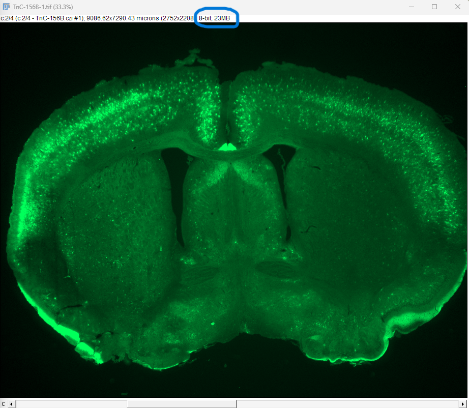 Une image de microscopie à fluorescence d’une coupe coronale de cerveau de souris affichée dans une visionneuse d’images. L’image est issue d’un fichier `.czi` et présentée sous forme de TIFF 8 bits avec une taille de 23 Mo. Le signal de fluorescence apparaît en vert, mettant en évidence des structures spécifiques au sein du tissu cérébral. Les métadonnées affichées dans la visionneuse indiquent des dimensions de 9086.62 x 7290.43 microns, correspondant à une résolution de 2752 x 2208 pixels. Ce type d’imagerie est couramment utilisé en recherche en neurosciences pour visualiser l’expression des protéines, les structures cellulaires ou les régions anatomiques.