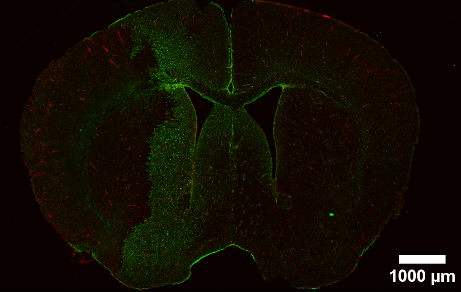 Fluorescence microscopy image of a coronal section of a mouse brain. The section is stained with immunofluorescence markers